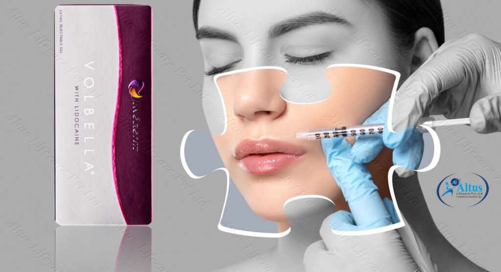 Juvederm Volbella Injection 8