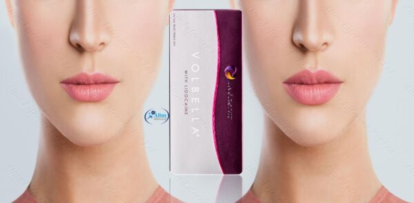Juvederm Volbella Injection 9