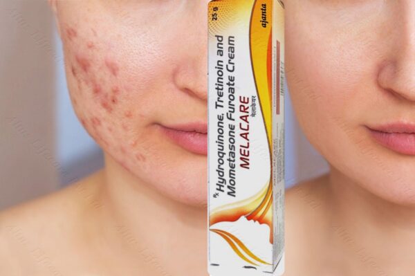 Melacare Cream 2