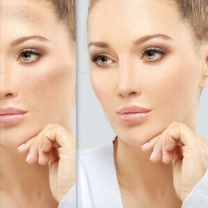Melacare Cream 6