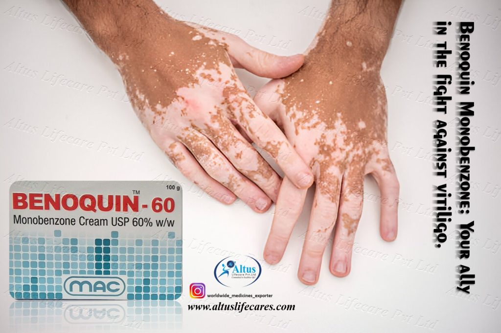 60 Monobenzone Cream